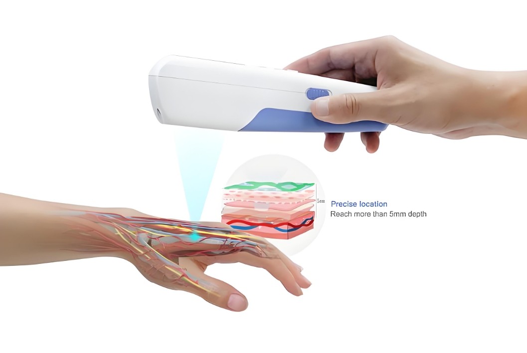 濾光片 靜脈顯像